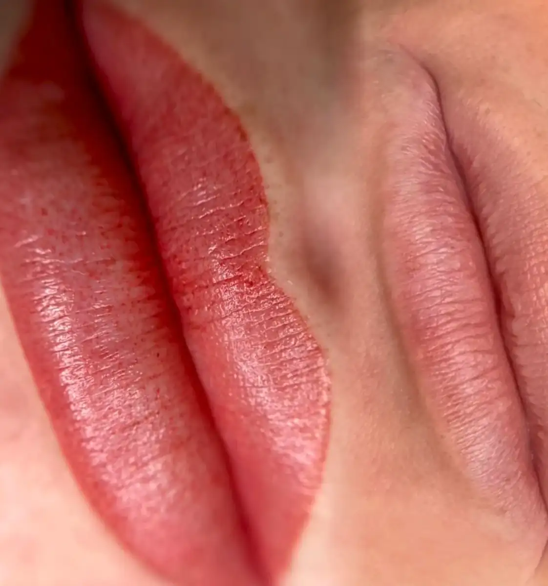 What is cosmetic tattoo bubbling