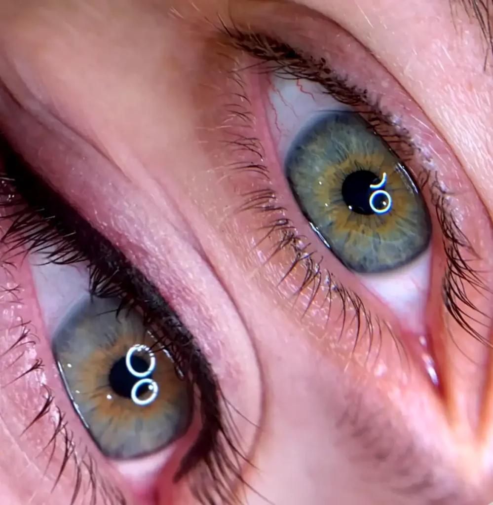 Cosmetic Tattoo Bubbling